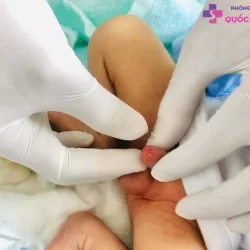 https://dakhoaquoctebacninh.vn/wp-content/uploads/2023/08/hep-bao-quy-dau-o-tre-1.jpg-250x250.webp