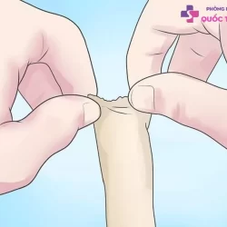 https://dakhoaquoctebacninh.vn/wp-content/uploads/2023/09/lot-bao-quy-dau-la-gi-1.jpg-250x250.webp
