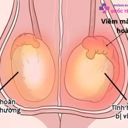 https://dakhoaquoctebacninh.vn/wp-content/uploads/2023/10/viem-mao-tinh-hoan-co-nguy-hiem-khong-1.jpg-250x250.webp