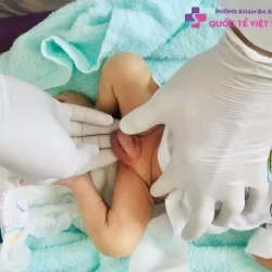 https://dakhoaquoctebacninh.vn/wp-content/uploads/2023/11/viem-tinh-hoan-o-tre-so-sinh-1.jpg-250x250.webp