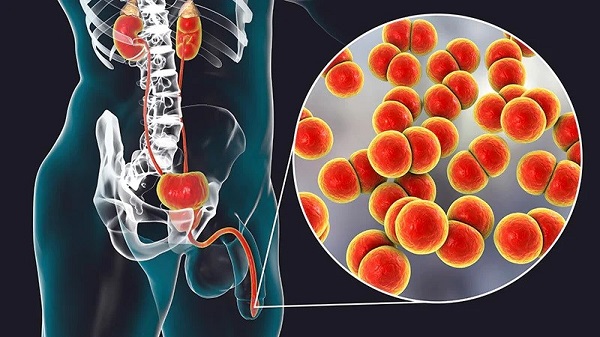 Giải đáp: Đi tiểu ra máu có gây ảnh hưởng gì không?