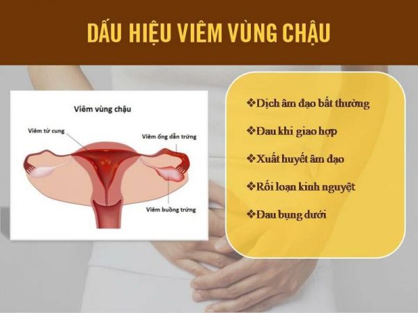 Chữa viêm vùng chậu Bắc Ninh ở đâu tốt? Chuyên gia gợi ý 10 lựa chọn tin cậy
